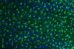 Cellules microgliales (en vert) et noyaux des cellules microgliales et autres cellules dont les neurones (en bleu) © INRAE