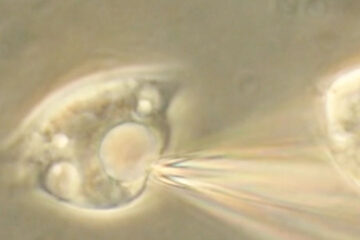 Workshop: Introduction of endolysosomal patch-clamp recordings